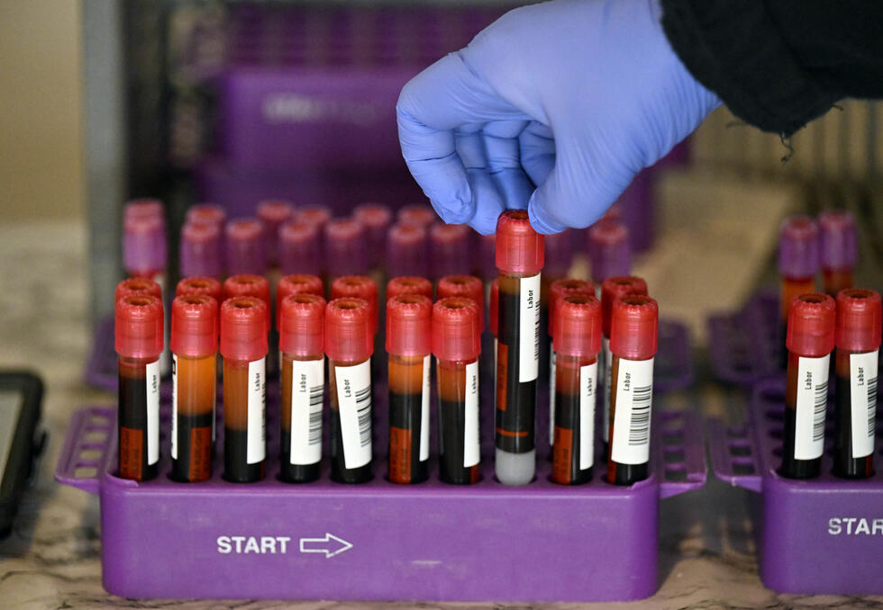 Hand lifts a blood sample