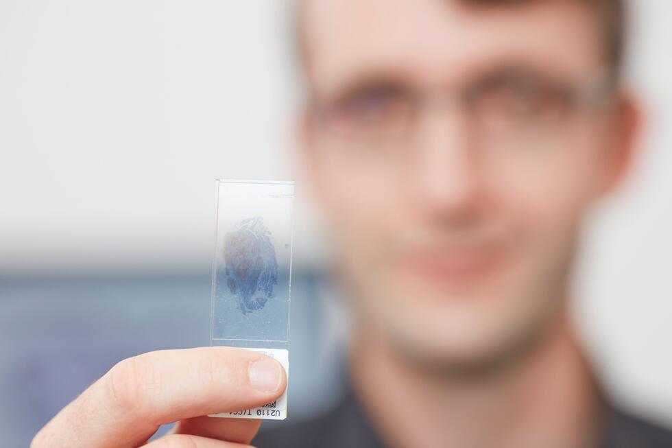 Viktor Kölzer, Professor of Computer-Aided Image Analysis in Pathology at the Zurich University Hospital